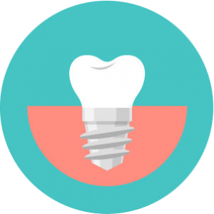 implantologia dentale brescia